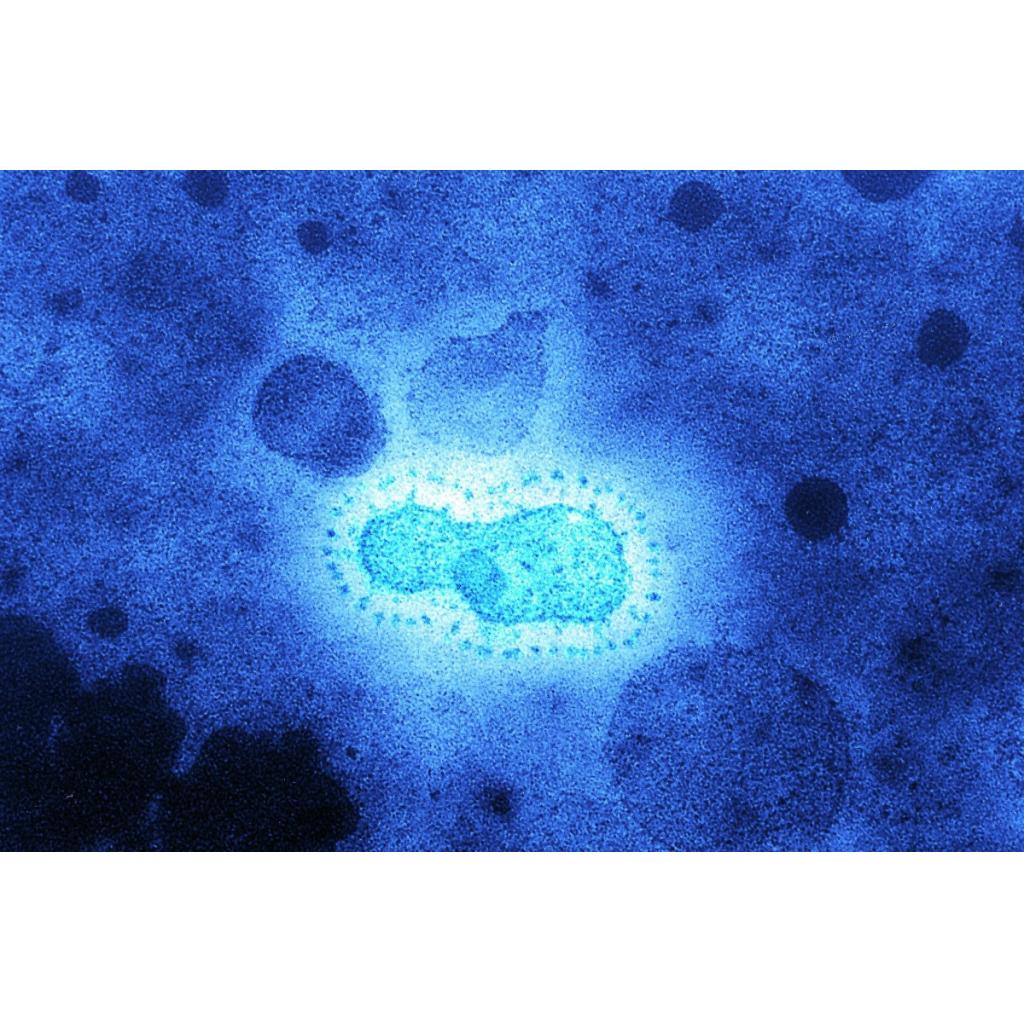 Dünyayı Sarsanlar – Koronavirüs Salgını